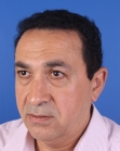 After Hair Transplant&nbsp;Front